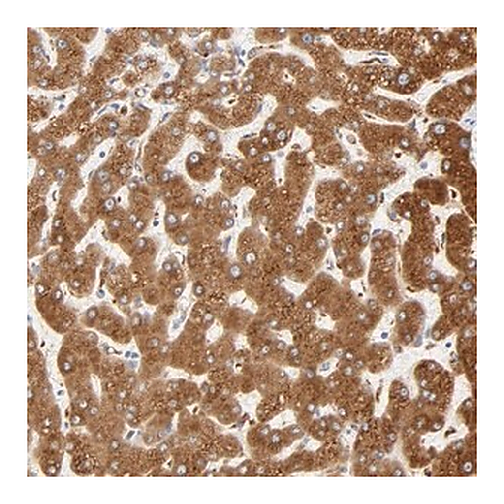 Merck Anti-MAGEB17 antibody produced in rabbit