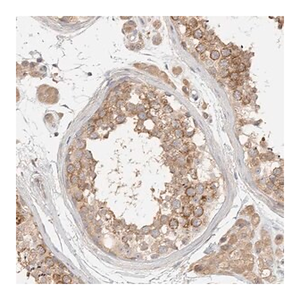 Merck Anti-HDAC6 antibody produced in rabbit