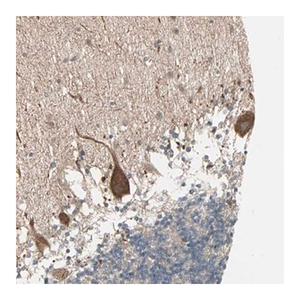 Merck Anti-JMJD7 antibody produced in rabbit