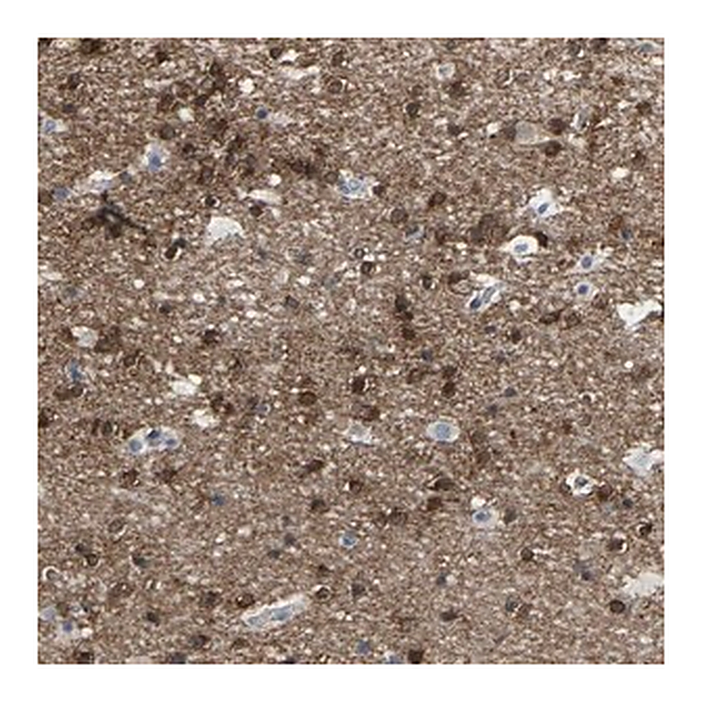 Merck Anti-ABTB2 antibody produced in rabbit