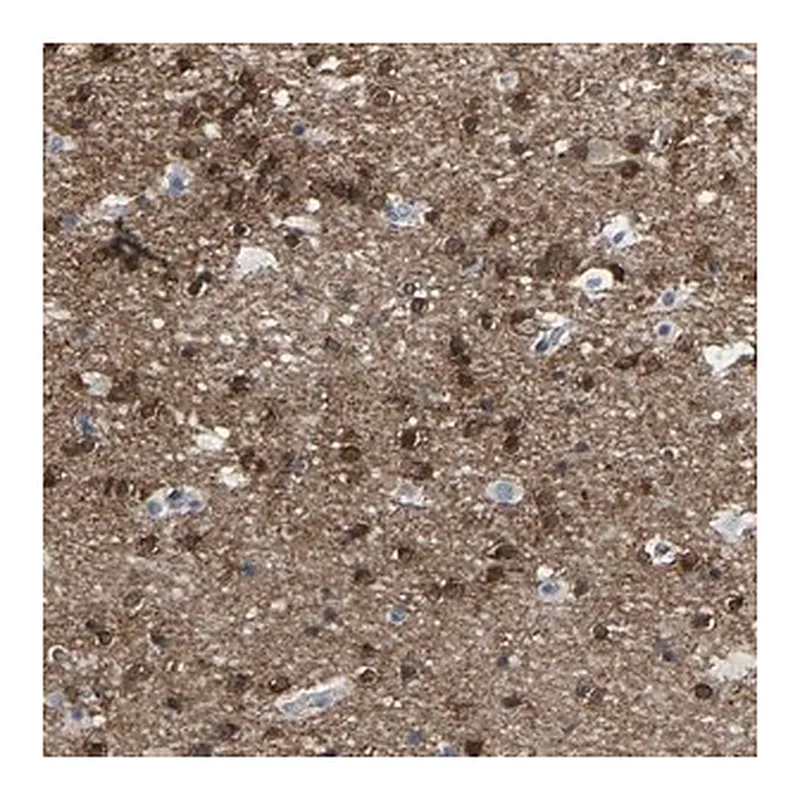 Merck Anti-ABTB2 antibody produced in rabbit
