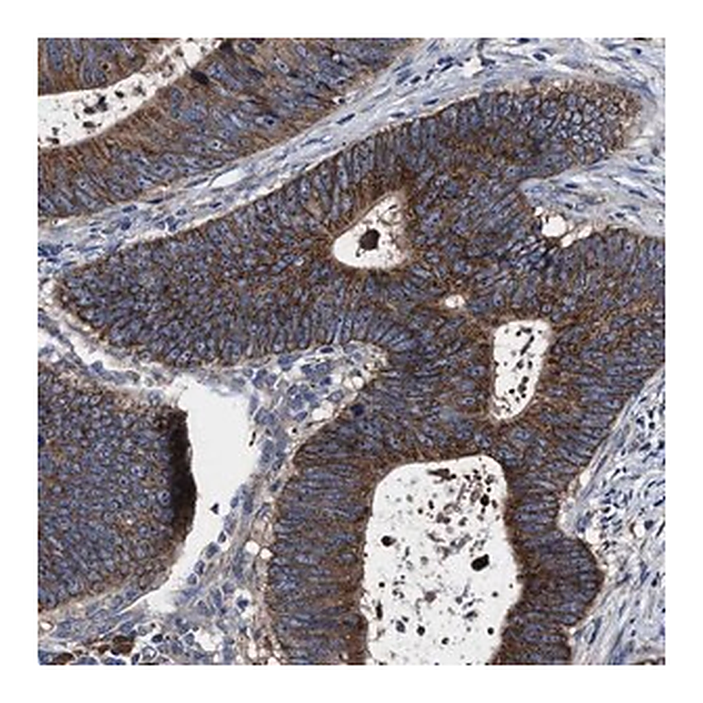 Merck Anti-MACC1 antibody produced in rabbit