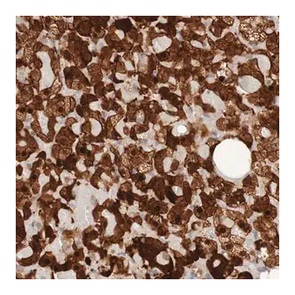 Merck Anti-PARP4 antibody produced in rabbit