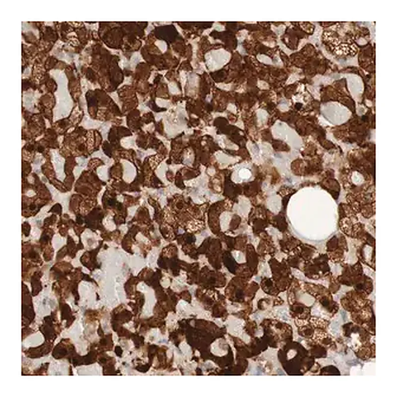 Merck Anti-PARP4 antibody produced in rabbit