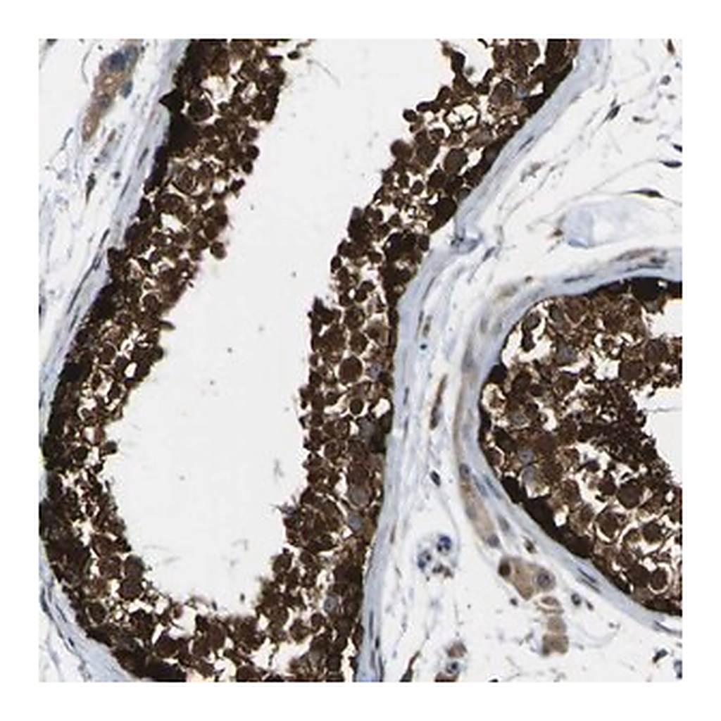 Merck Anti-LBHD1 antibody produced in rabbit