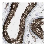 Merck Anti-LBHD1 antibody produced in rabbit