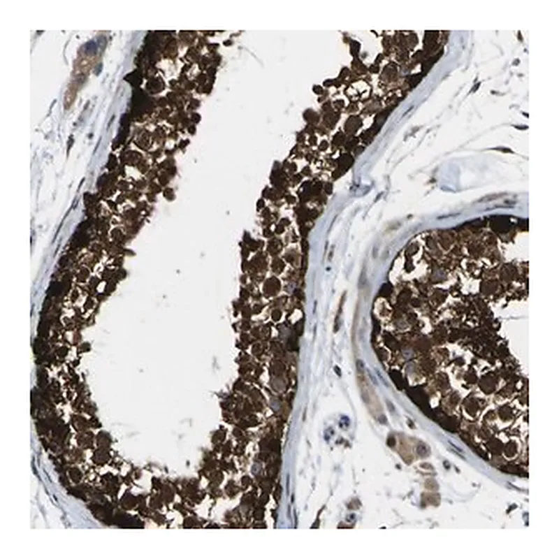 Merck Anti-LBHD1 antibody produced in rabbit