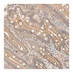 Merck Anti-TNK1 antibody produced in rabbit