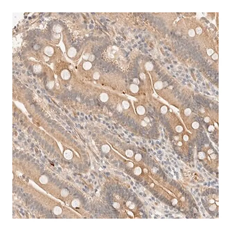 Merck Anti-TNK1 antibody produced in rabbit