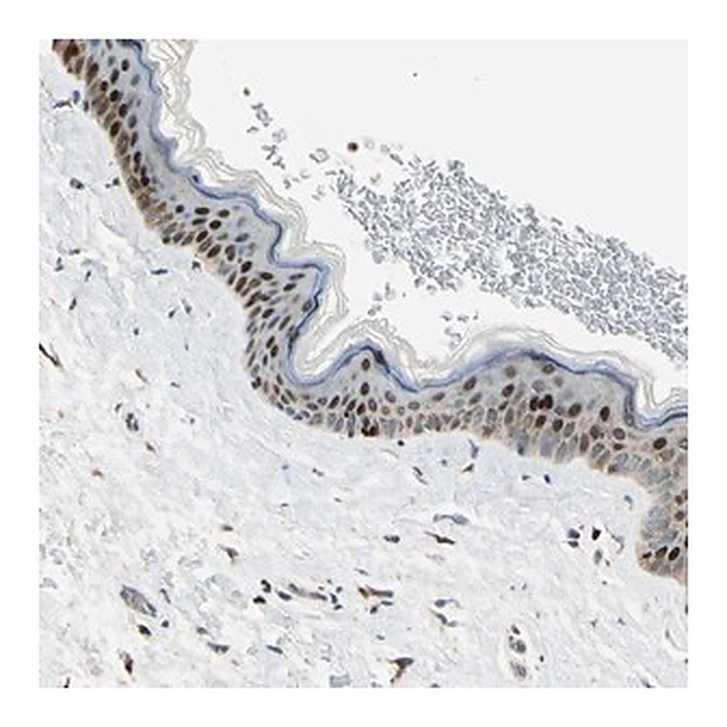 Merck Anti-IP6K2 antibody produced in rabbit