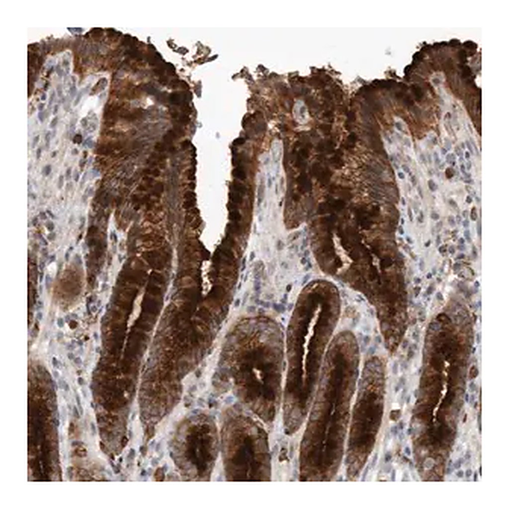 Merck Anti-MLPH antibody produced in rabbit