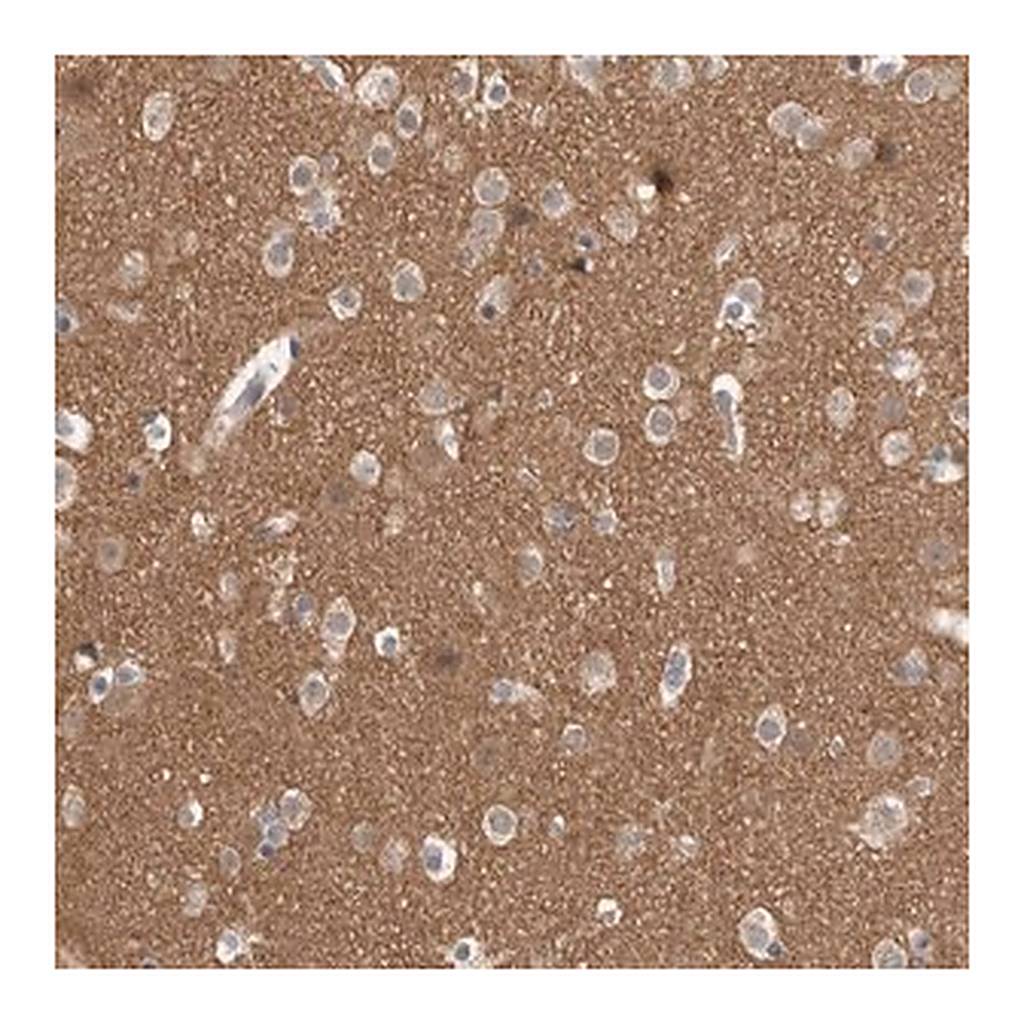 Merck Anti-ADGRL3 antibody produced in rabbit