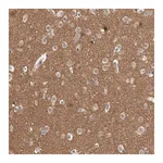 Merck Anti-ADGRL3 antibody produced in rabbit