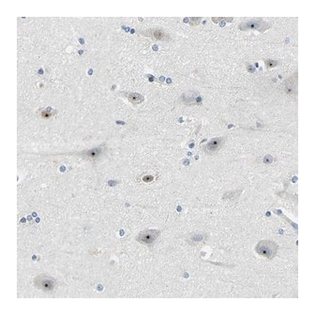 Merck Anti-RRP1 antibody produced in rabbit
