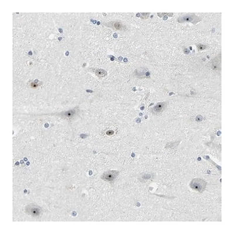 Merck Anti-RRP1 antibody produced in rabbit | 캐시바이