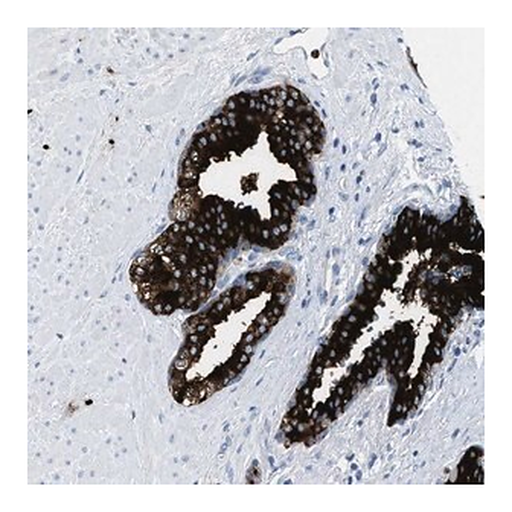 Merck Anti-CMTM1 antibody produced in rabbit