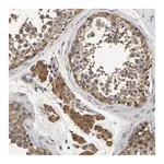 Merck Anti-STK32C antibody produced in rabbit
