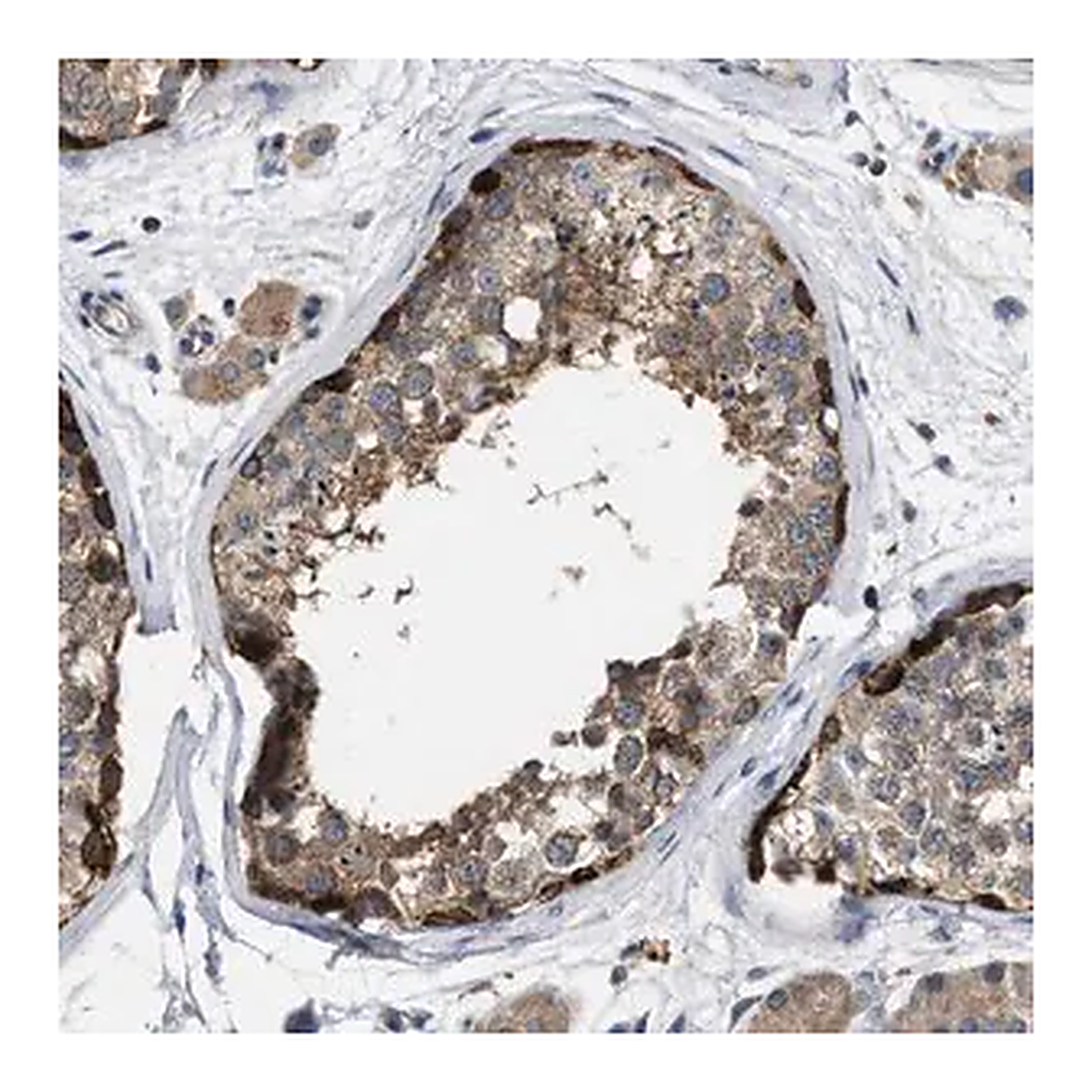 Merck Anti-TMEM131 antibody produced in rabbit