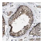 Merck Anti-TMEM131 antibody produced in rabbit
