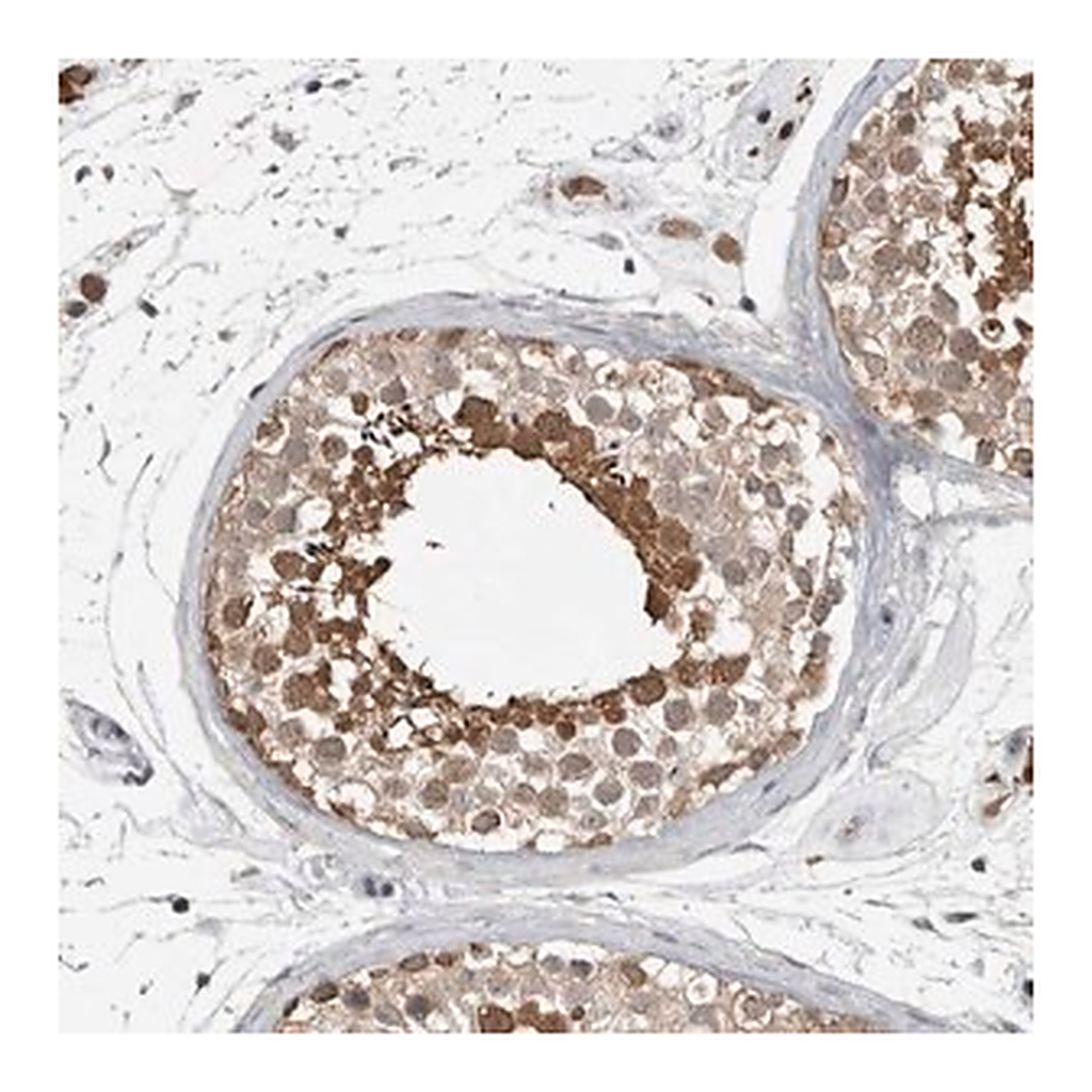 Merck Anti-MFAP3L antibody produced in rabbit