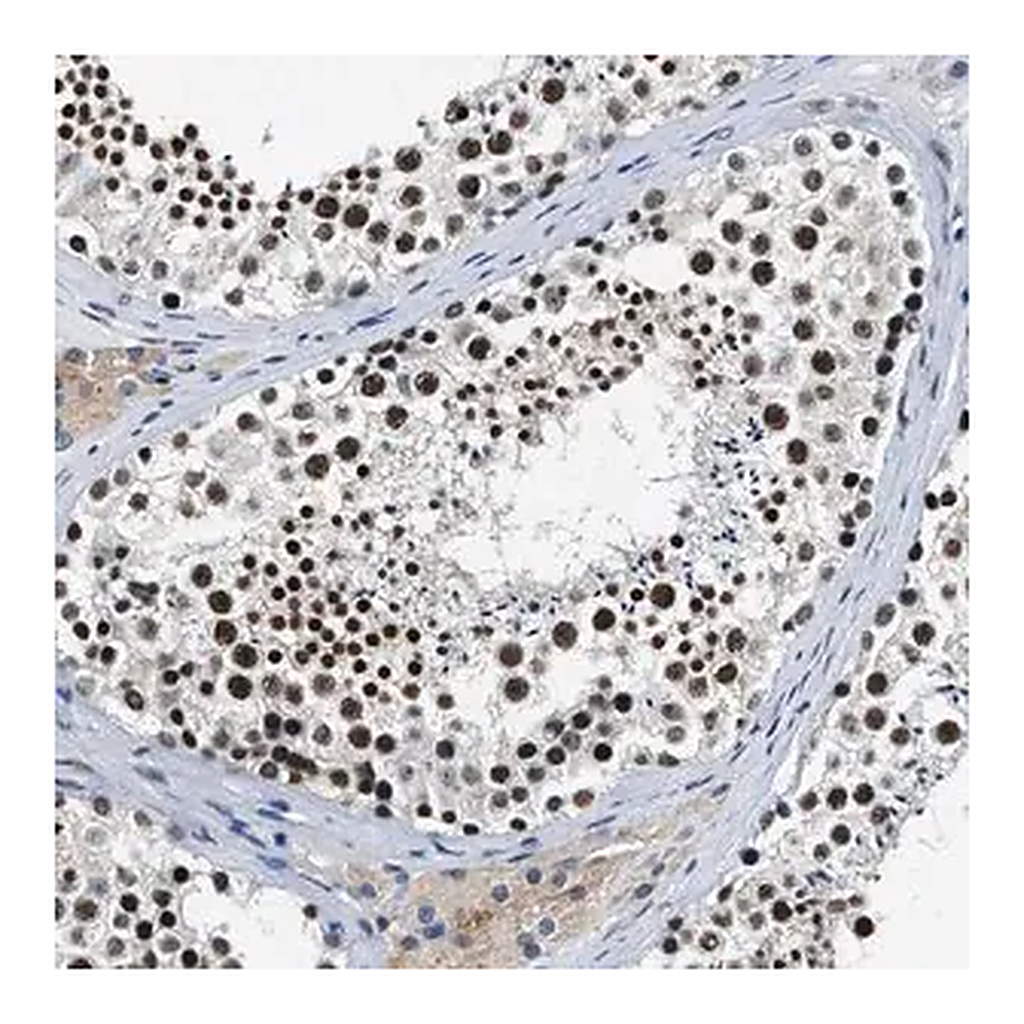 Merck Anti-CCNE1 antibody produced in rabbit