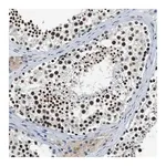Merck Anti-CCNE1 antibody produced in rabbit