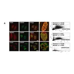 Merck Anti-TOX4 antibody produced in rabbit