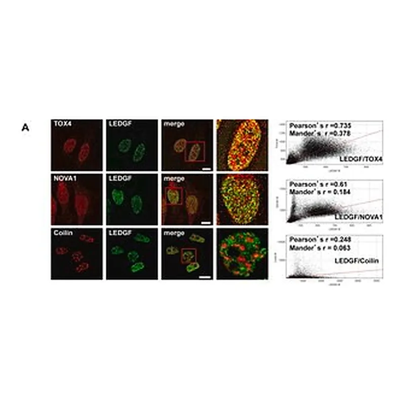 Merck Anti-TOX4 antibody produced in rabbit