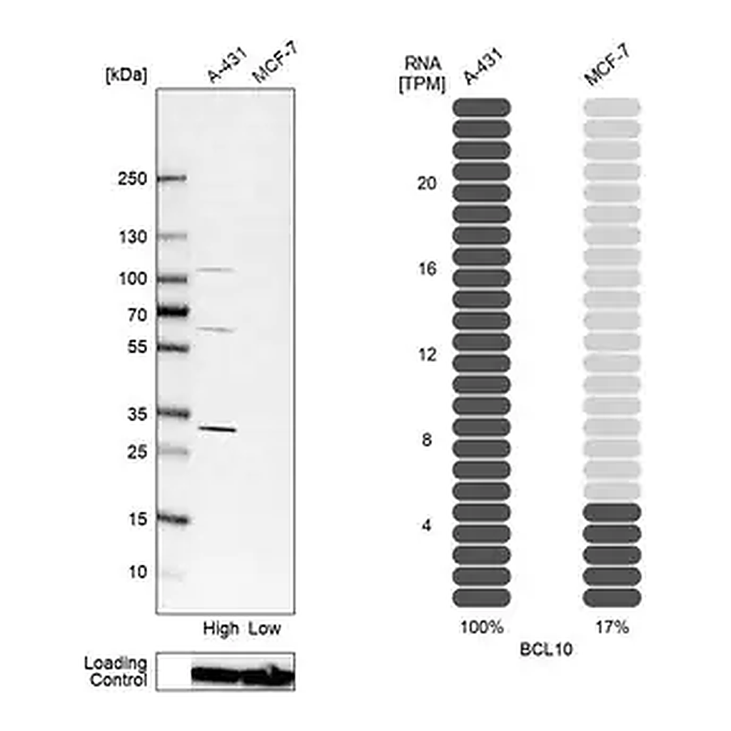 Merck Anti-BCL10 antibody produced in rabbit