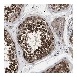 Merck Anti-UPF3A antibody produced in rabbit