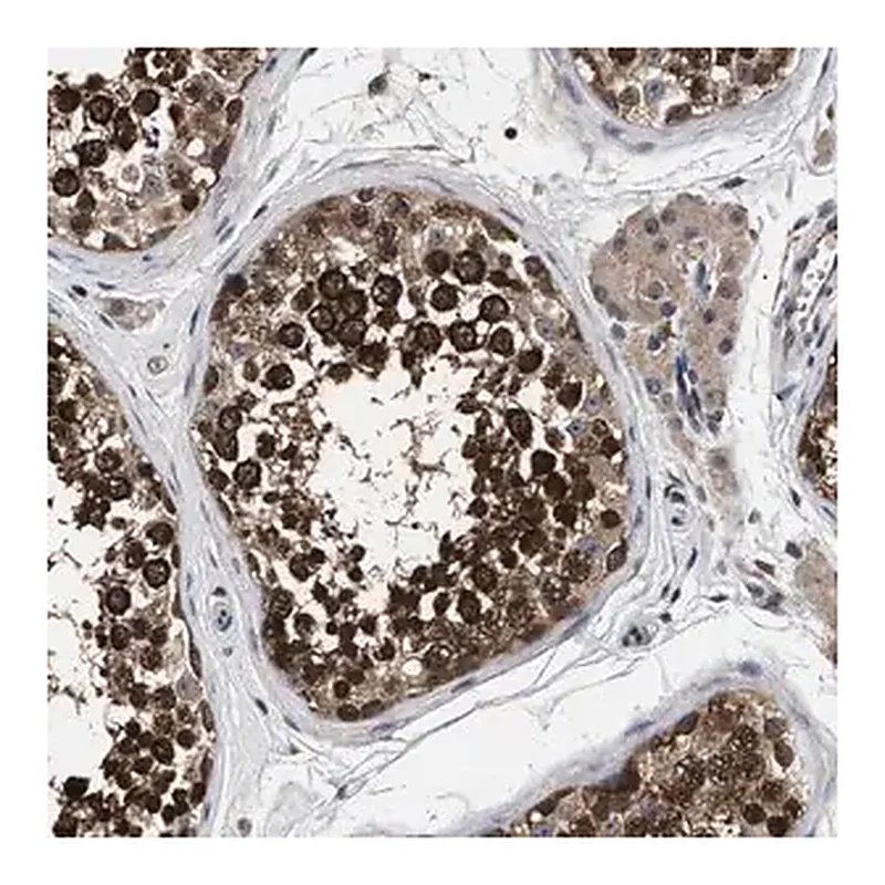 Merck Anti-UPF3A antibody produced in rabbit