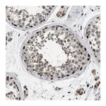 Merck Anti-LSM8 antibody produced in rabbit