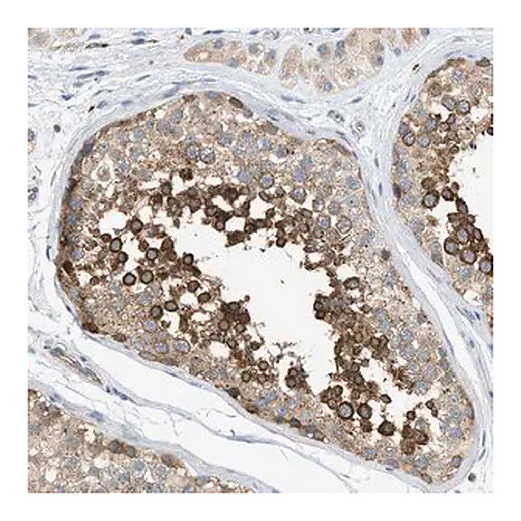 Merck Anti-KLHDC10 antibody produced in rabbit