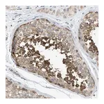 Merck Anti-KLHDC10 antibody produced in rabbit