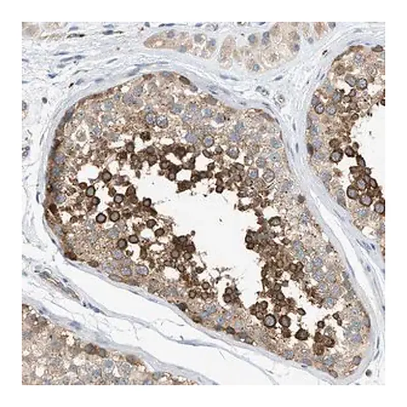 Merck Anti-KLHDC10 antibody produced in rabbit