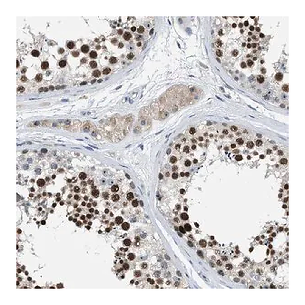 Merck Anti-ZNF783 antibody produced in rabbit