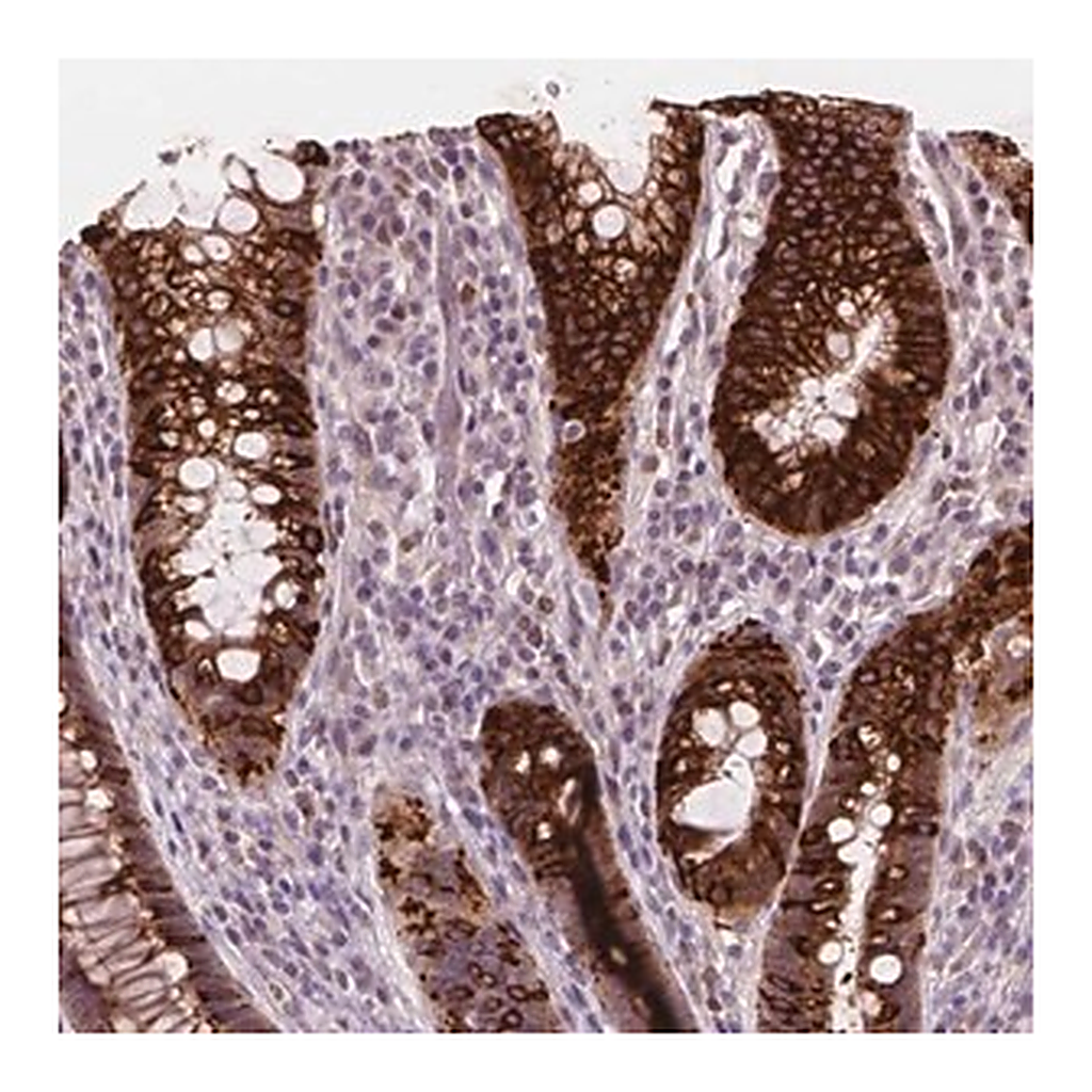 Merck Anti-DUSP16 antibody produced in rabbit