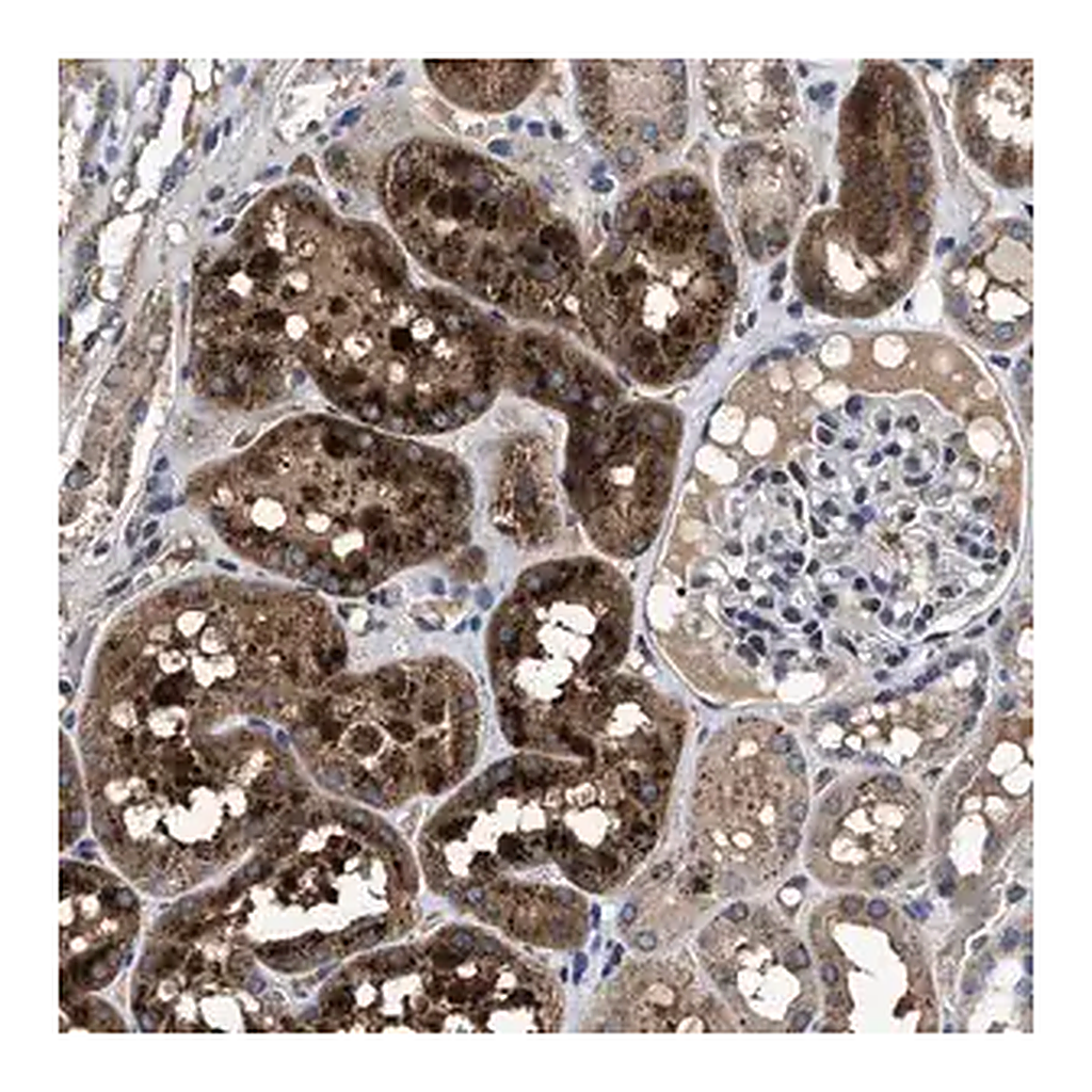 Merck Anti-CACNA1D antibody produced in rabbit