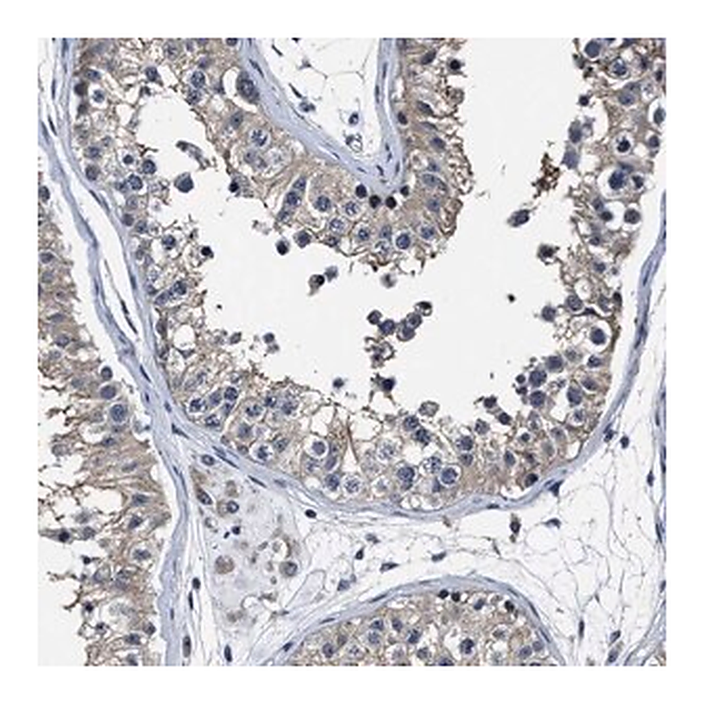 Merck Anti-RSBN1L antibody produced in rabbit