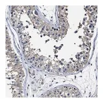 Merck Anti-RSBN1L antibody produced in rabbit