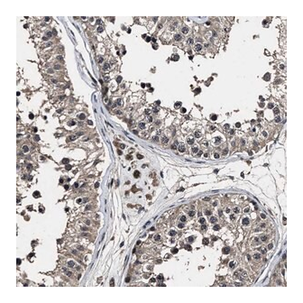 Merck Anti-RSBN1L antibody produced in rabbit
