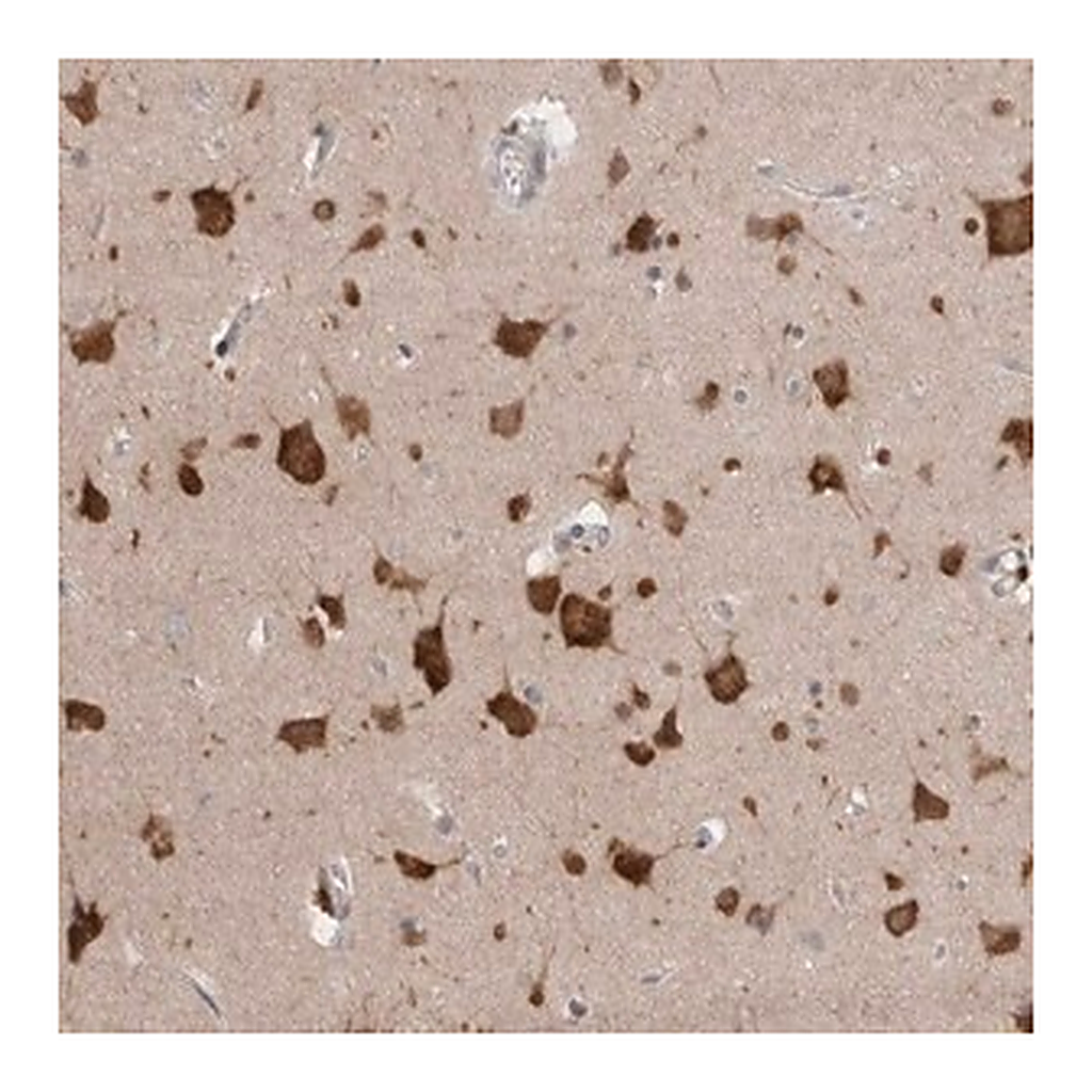 Merck Anti-RASAL2 antibody produced in rabbit