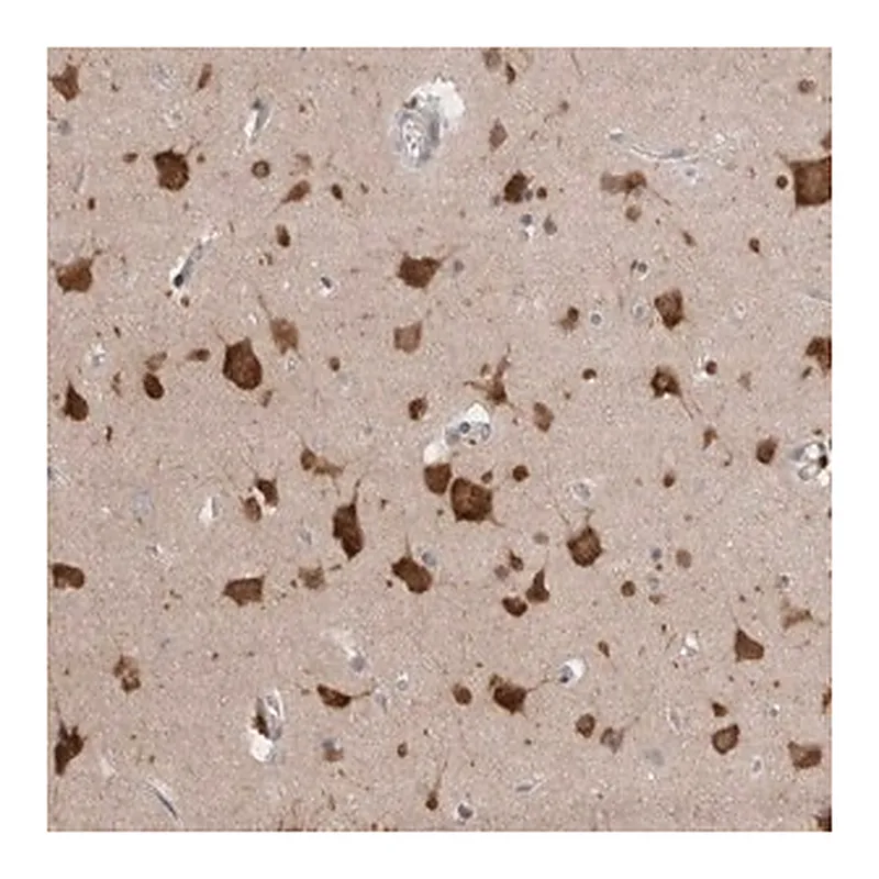 Merck Anti-RASAL2 antibody produced in rabbit
