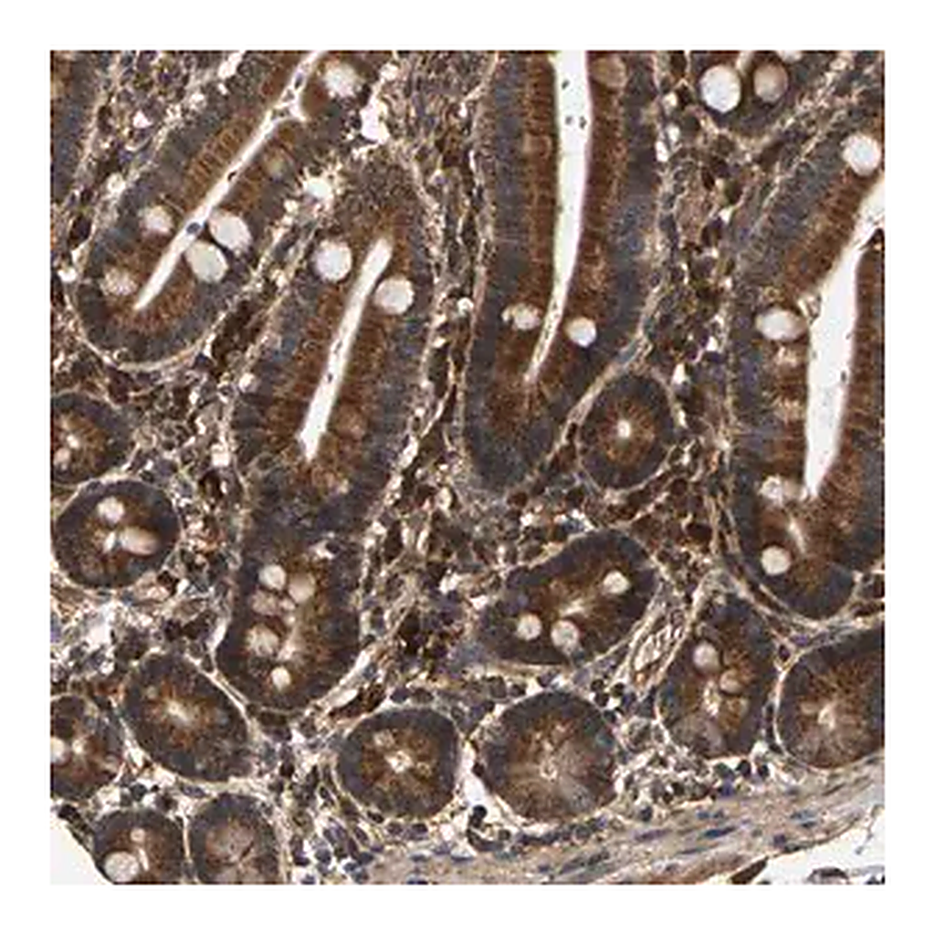 Merck Anti-CIDEC antibody produced in rabbit