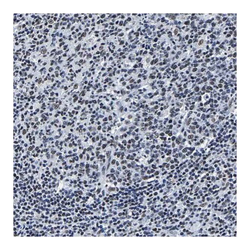 Merck Anti-RBM45 antibody produced in rabbit