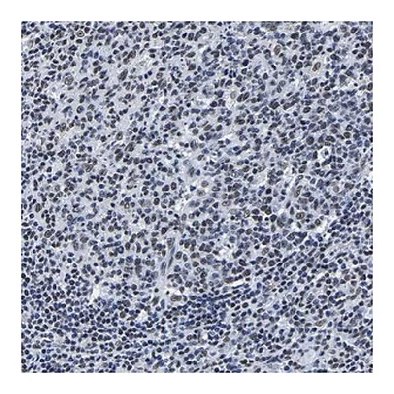Merck Anti-RBM45 antibody produced in rabbit