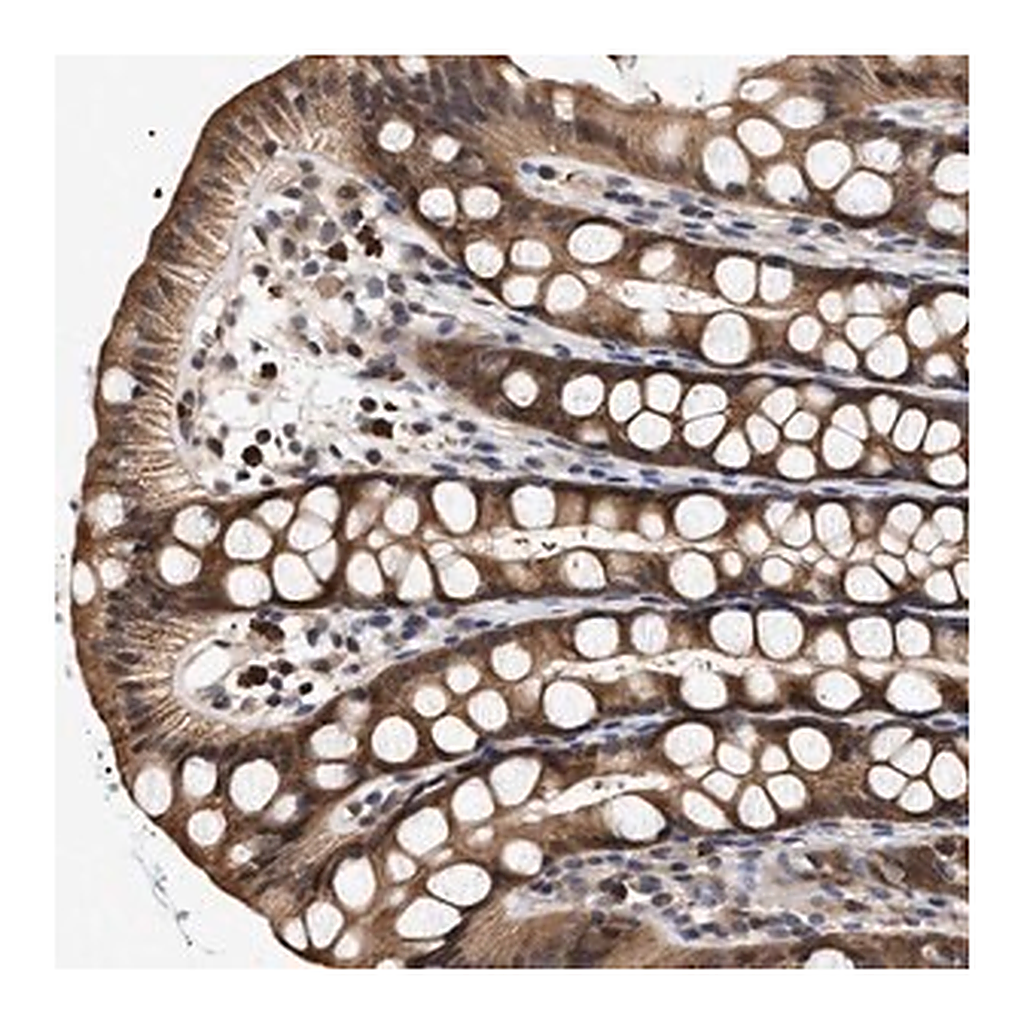 Merck Anti-KLHDC1 antibody produced in rabbit