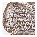 Merck Anti-KLHDC1 antibody produced in rabbit