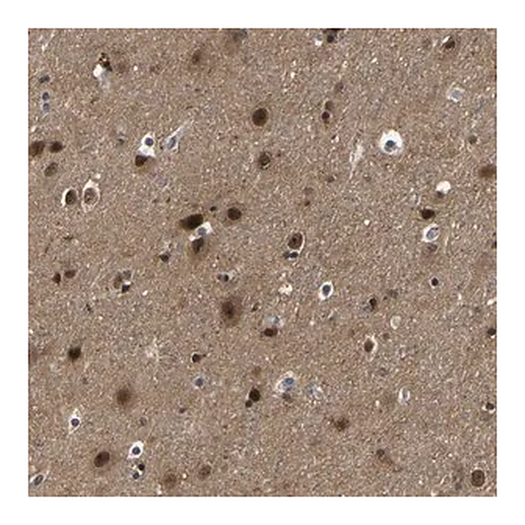 Merck Anti-PPM1E antibody produced in rabbit