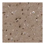 Merck Anti-PPM1E antibody produced in rabbit
